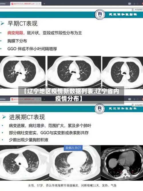 【辽宁地区疫情新数据列表,辽宁省内疫情分布】-第1张图片